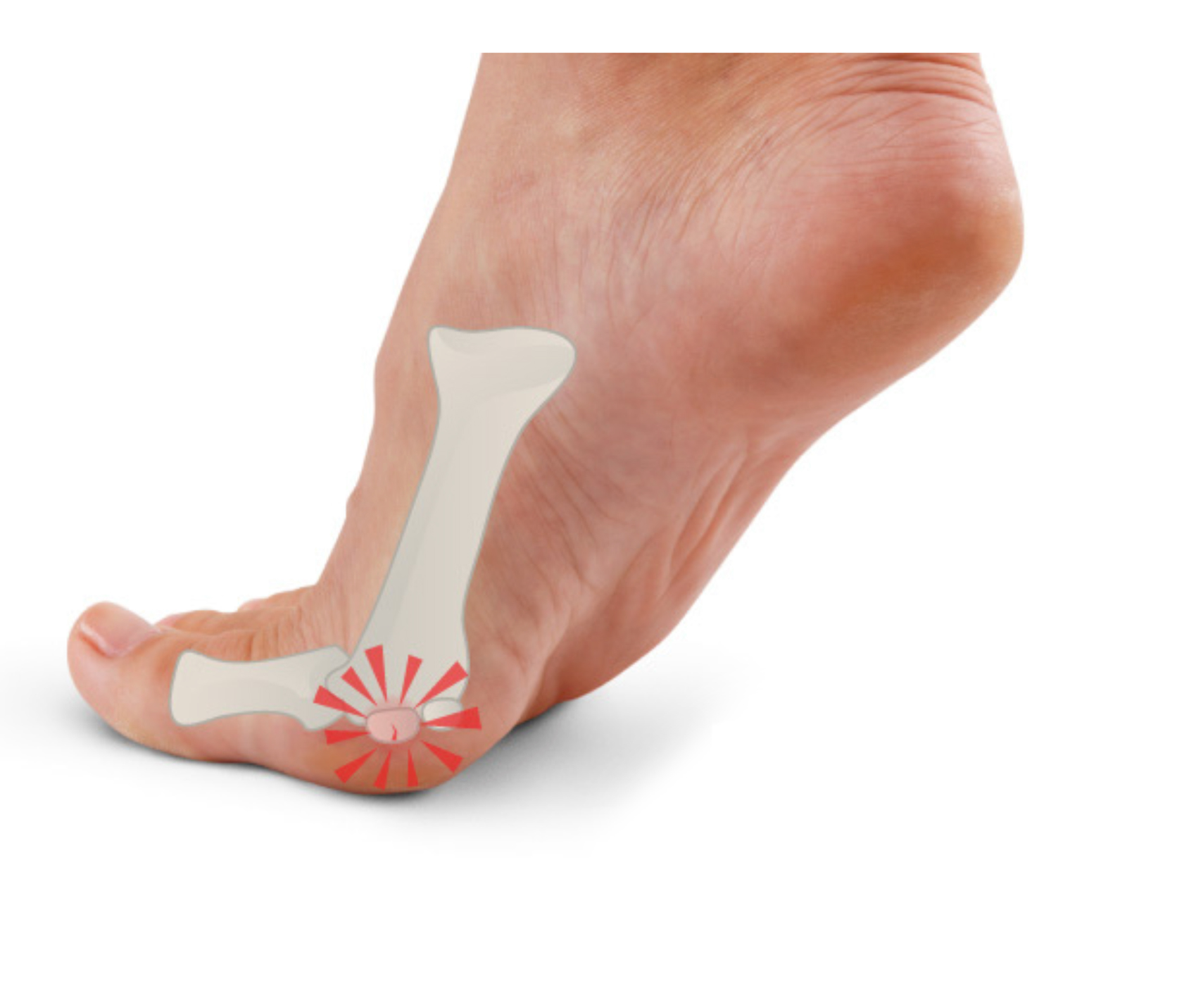 Toe Joint Pain